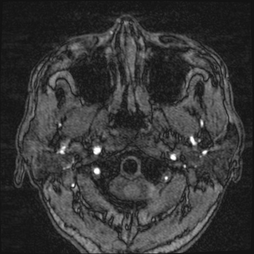 Click on the Serie image to view the images of VILLANUEVA, WILLIAM A.